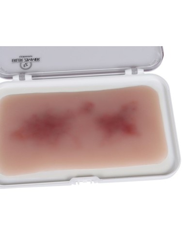 Moulage di Ferita Ematoma Fresco Erler Zimmer EZ NW117