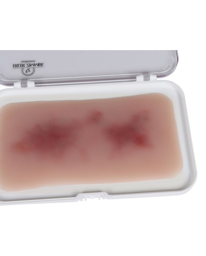 Moulage di Ferita Ematoma Fresco Erler Zimmer EZ NW117