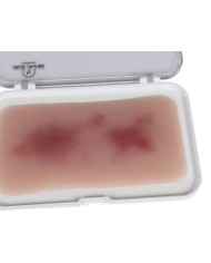 Moulage di Ferita Ematoma Fresco Erler Zimmer EZ NW117