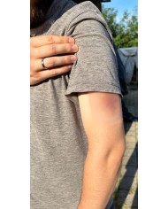 Moulage di Ferita Ematoma Vecchio EZ NW119