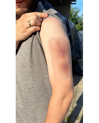 Moulage di Ferita Ematoma Vecchio EZ NW119