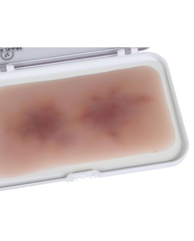 Moulage di Ferita Ematoma Vecchio EZ NW119