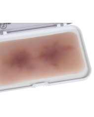 Moulage di Ferita Ematoma Vecchio EZ NW119