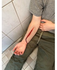 Moulage di Ferita Tentativo di Suicidio EZ NW121 