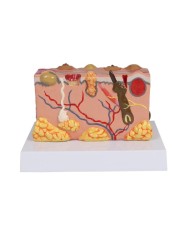 Modello di pelle patologica ingrandita 30 volte Erler Zimmer EZ J755