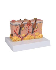 Modello di pelle patologica ingrandita 30 volte Erler Zimmer EZ J755