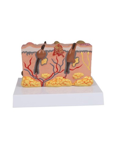 Modello di pelle patologica ingrandita 30 volte Erler Zimmer EZ J755