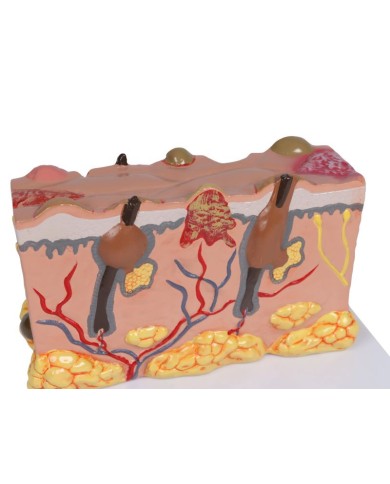 Modello di pelle patologica ingrandita 30 volte Erler Zimmer EZ J755