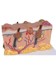 Modello di pelle patologica ingrandita 30 volte Erler Zimmer EZ J755