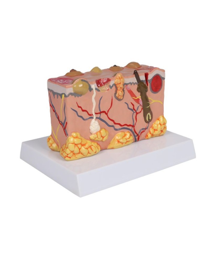 Modello di pelle patologica ingrandita 30 volte Erler Zimmer EZ J755