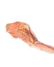 Arto Anteriore del Cane Muscoli Tendini Legamenti Vasi e Nervi Dista