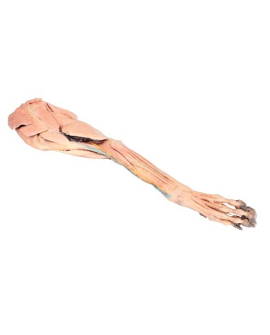 Arto Anteriore del Cane Muscoli Tendini Legamenti Vasi e Nervi Dista