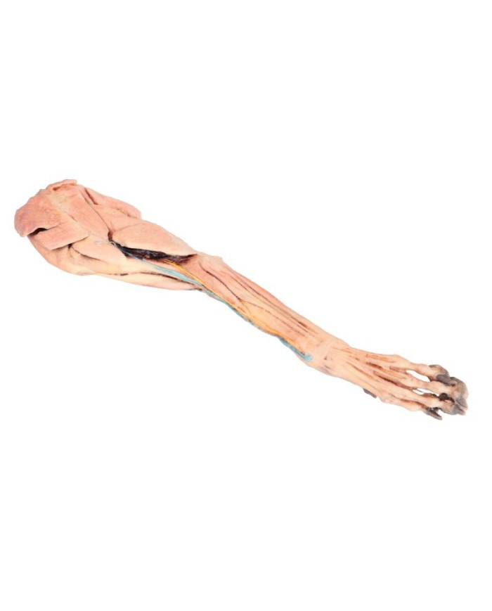 Arto Anteriore del Cane Muscoli Tendini Legamenti Vasi e Nervi Dista