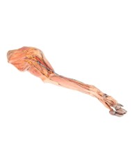 Arto Anteriore del Cane Muscoli Tendini Legamenti Vasi e Nervi Dista