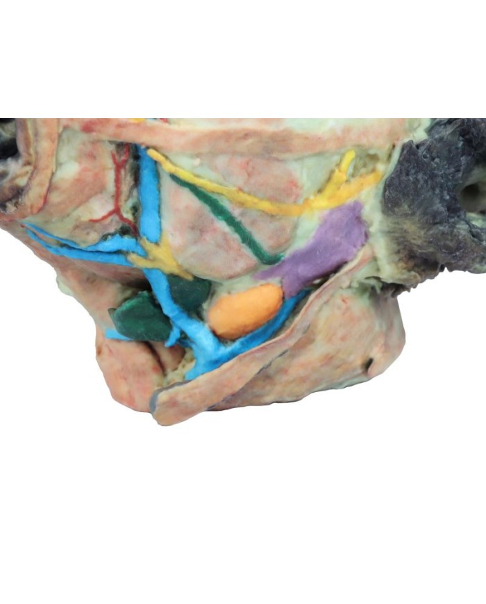 Testa del Cane Dissezioni Superficiali e Profonde VP9000