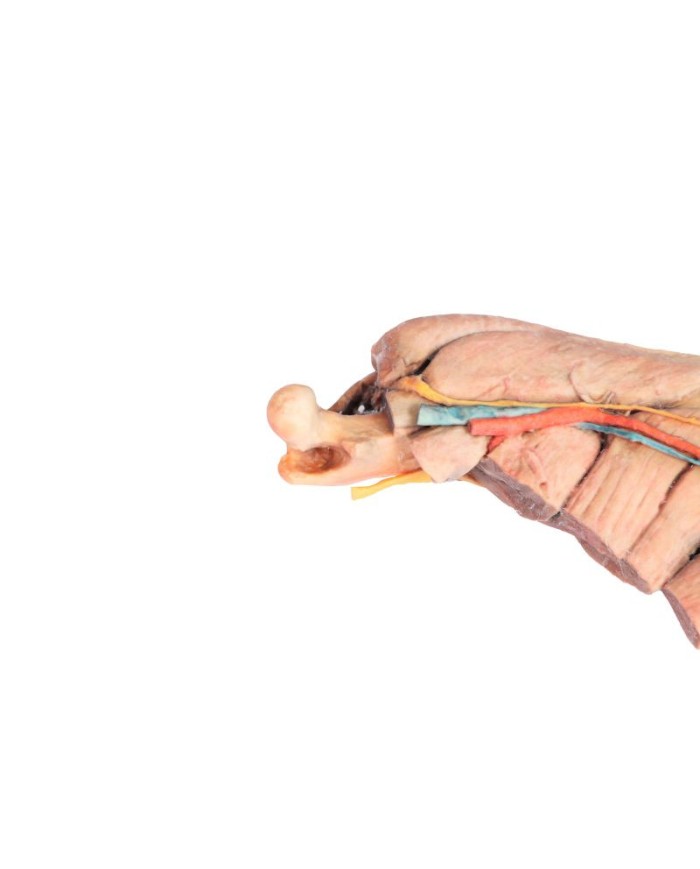 Arto Posteriore del Cane Muscoli Tendini Legamenti Vasi e Nervi Dist