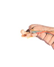 Arto Posteriore del Cane Muscoli Tendini Legamenti Vasi e Nervi Dist