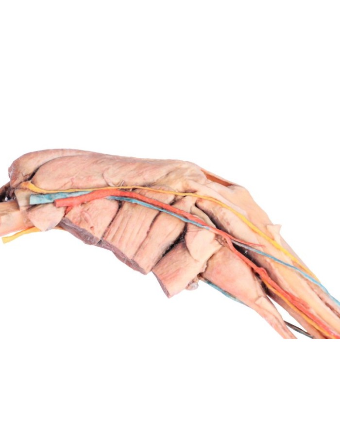 Arto Posteriore del Cane Muscoli Tendini Legamenti Vasi e Nervi Dist