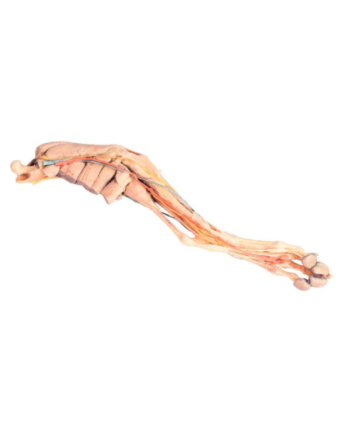 Arto Posteriore del Cane Muscoli Tendini Legamenti Vasi e Nervi Dist