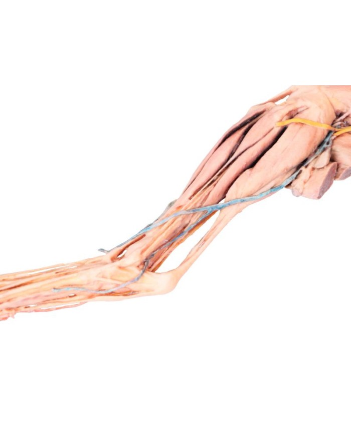 Arto Posteriore del Cane Muscoli Tendini Legamenti Vasi e Nervi Dist