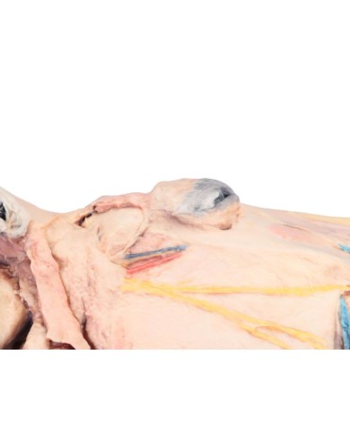 Sezione Sagittale della Testa del Cavallo VP10000