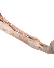 Arto Anteriore del Cavallo Muscoli Tendini Legamenti Vasi e Nervi Di