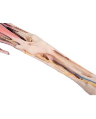 Arto Anteriore del Cavallo Muscoli Tendini Legamenti Vasi e Nervi Di