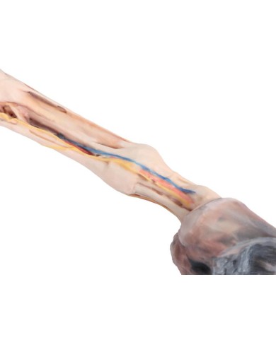 Arto Anteriore del Cavallo Muscoli Tendini Legamenti Vasi e Nervi Di