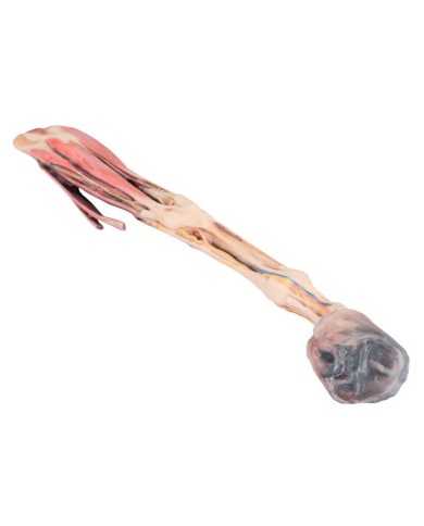 Arto Anteriore del Cavallo Muscoli Tendini Legamenti Vasi e Nervi Di