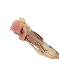 Arto Posteriore del Cavallo Muscoli Tendini Legamenti Vasi e Nervi d