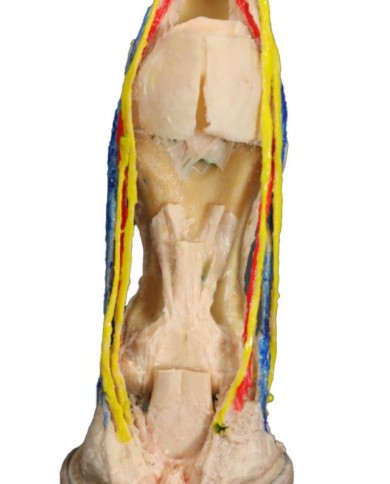 Dissezione Palmare Profonda del Piede del Cavallo VP10040