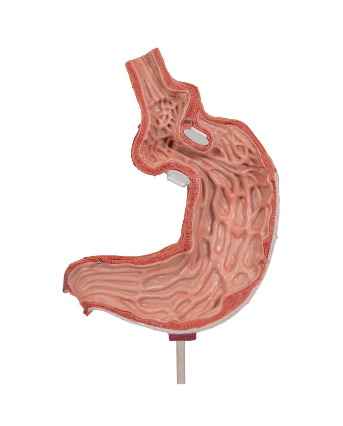 Modello di bendaggio gastrico 3B Scientific K15 1