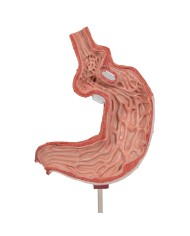 Modello di bendaggio gastrico 3B Scientific K15 1