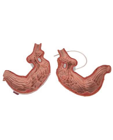 Modello di bendaggio gastrico 3B Scientific K15 1 Modello di bendaggio gastrico 3B Scientific K15 1