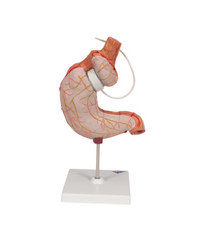 Modello di bendaggio gastrico 3B Scientific K15 1