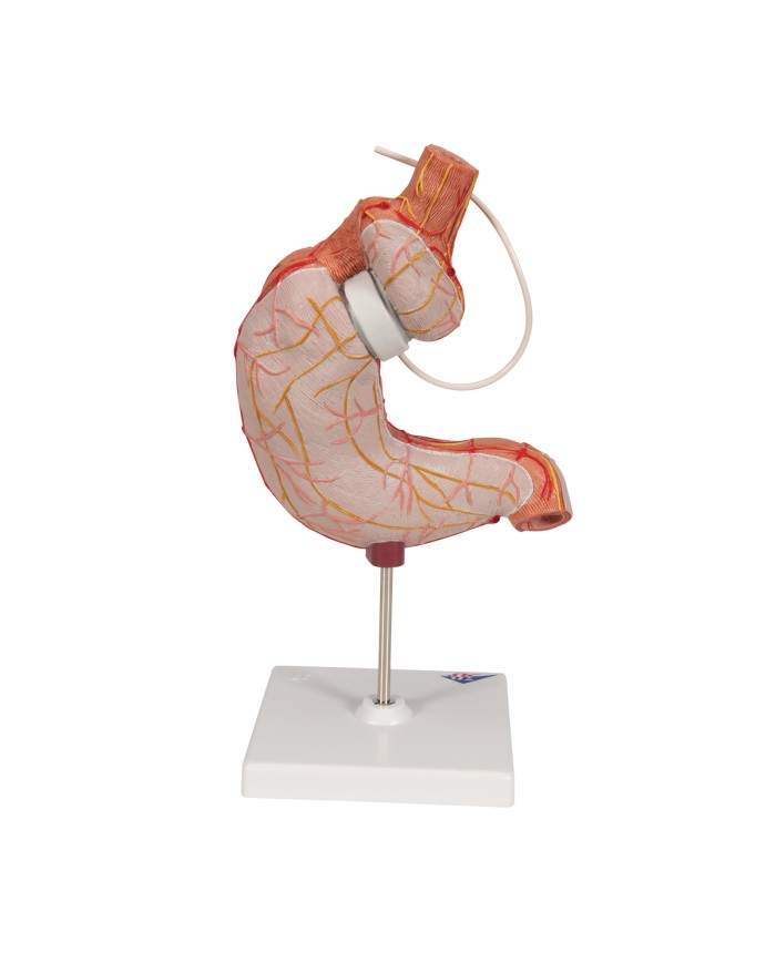 Modello di bendaggio gastrico 3B Scientific K15 1