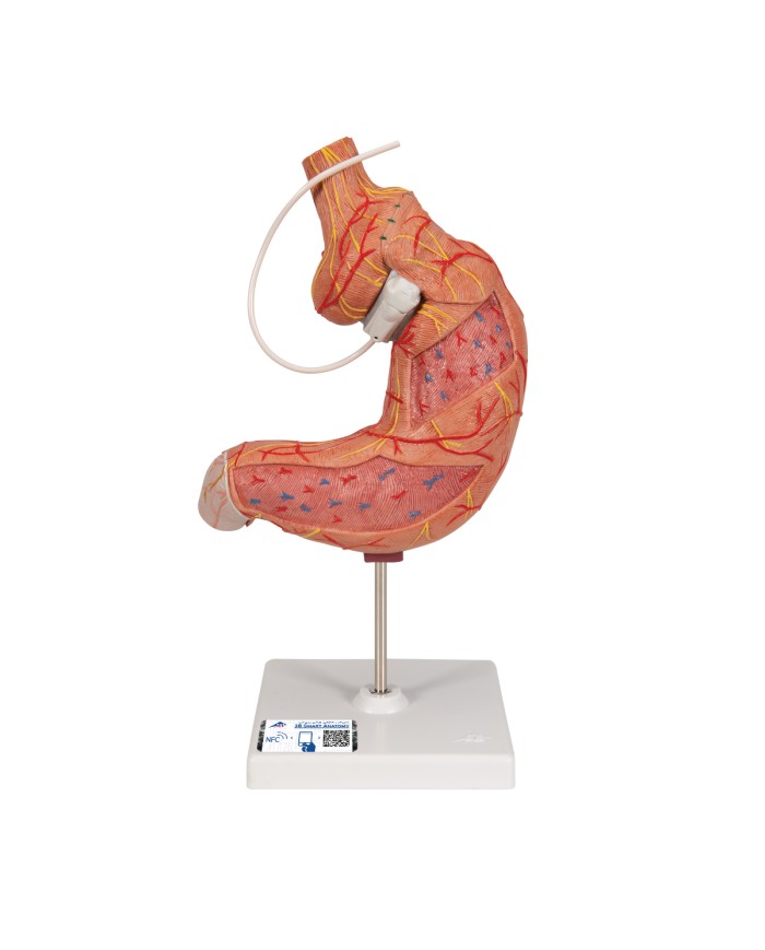 Modello di bendaggio gastrico 3B Scientific K15 1