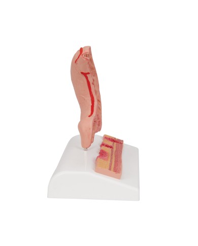 Modello anatomico di Stomaco con ulcere gastriche 3B Scientific K17 Modello anatomico di Stomaco con ulcere gastriche 3B Scientific K17