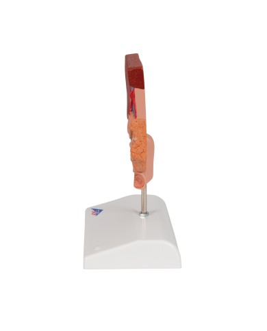 Modello anatomico di Calcoli biliari 3B Scientific K26 Modello anatomico di Calcoli biliari 3B Scientific K26