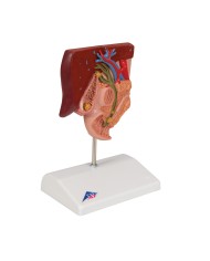 Modello anatomico di Calcoli biliari 3B Scientific K26