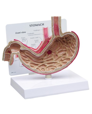 Modello di stomaco con ulcere 3B Scientific 1019523 Modello di stomaco con ulcere 3B Scientific 1019523
