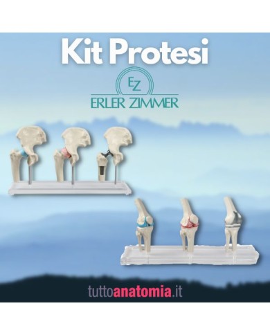 Kit articolazioni dell'anca e del ginocchio con protesi