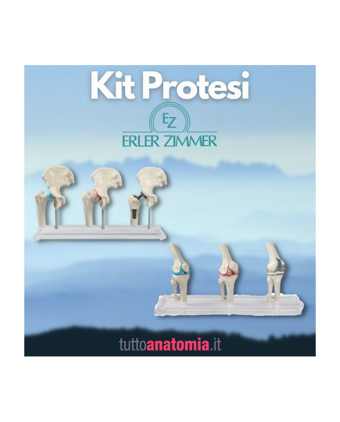 Kit articolazioni dell'anca e del ginocchio con protesi