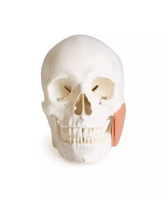 Modello di cranio per odontoiatria con sindrome CMD in 8 parti EZ 4860