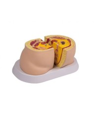 Erler Zimmer, modello anatomico di tipi di obesità M50