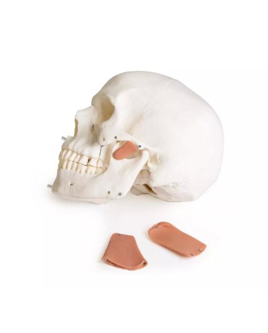 Modello di cranio per odontoiatria con sindrome CMD in 8 parti EZ 4860