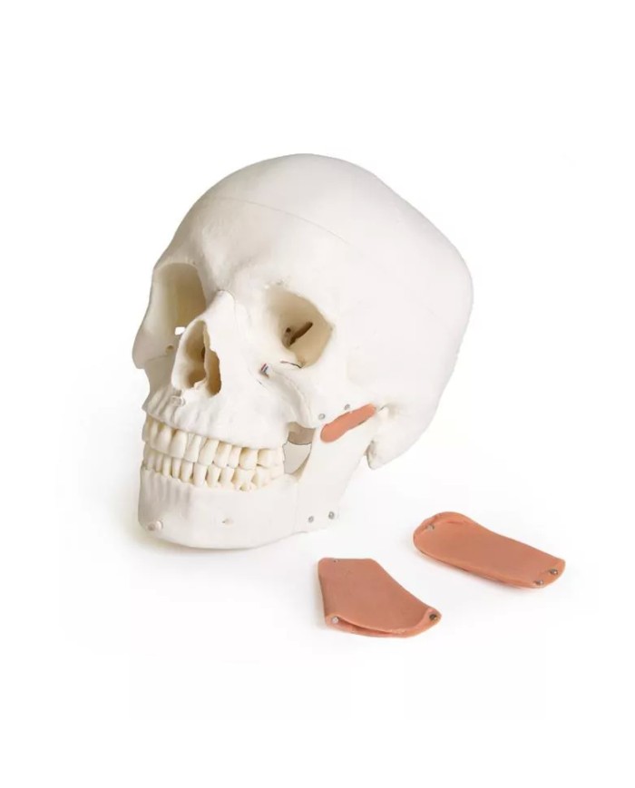 Modello di cranio per odontoiatria con sindrome CMD in 8 parti EZ 4860