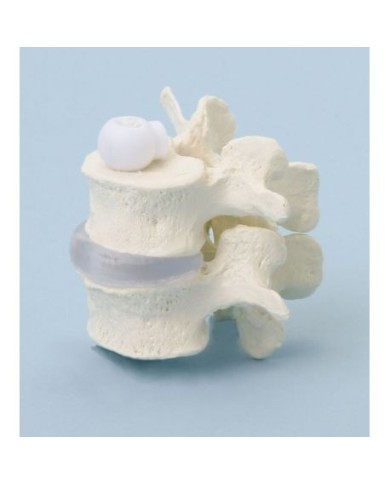 Erler Zimmer, modellino anatomico di due vertebre lombari a montaggio elastico