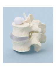 Erler Zimmer, modellino anatomico di due vertebre lombari a montaggio elastico
