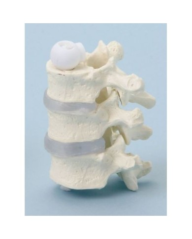 Erler Zimmer, modello anatomico di vertebre toraciche, a montaggio elastico